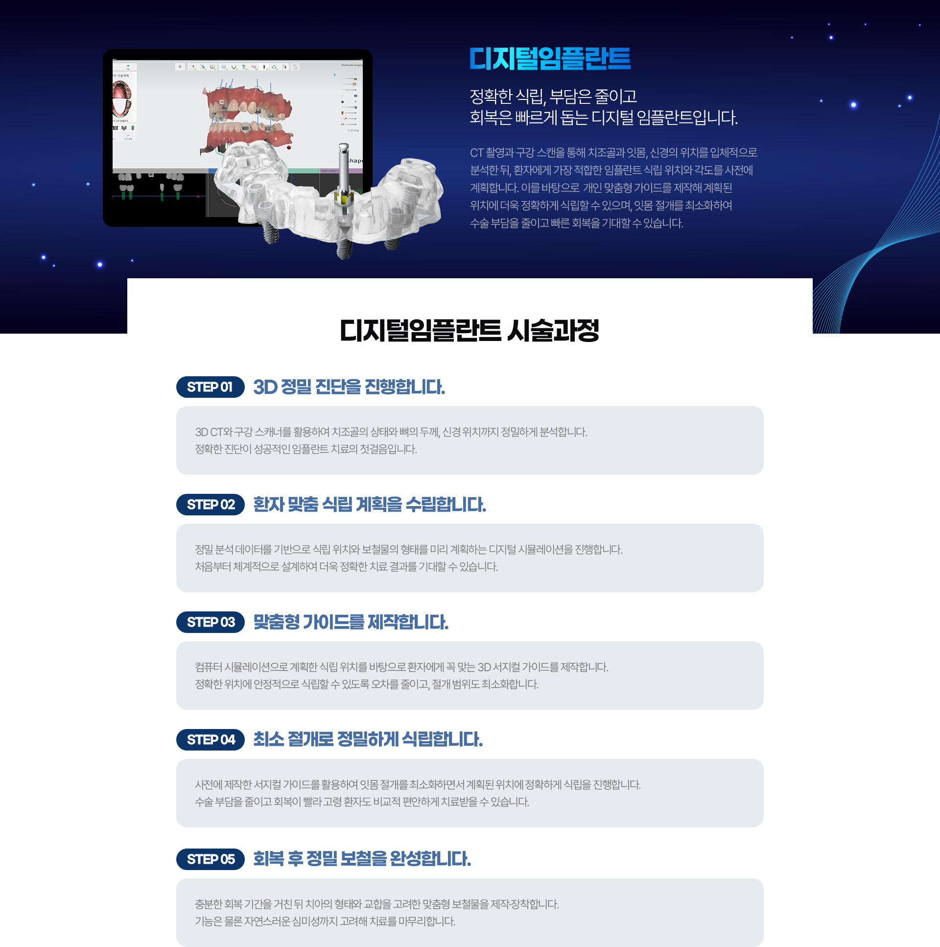 서울케이플란트치과 디지털임플란트 시술과정 3D 정밀진단 맞춤형 가이드