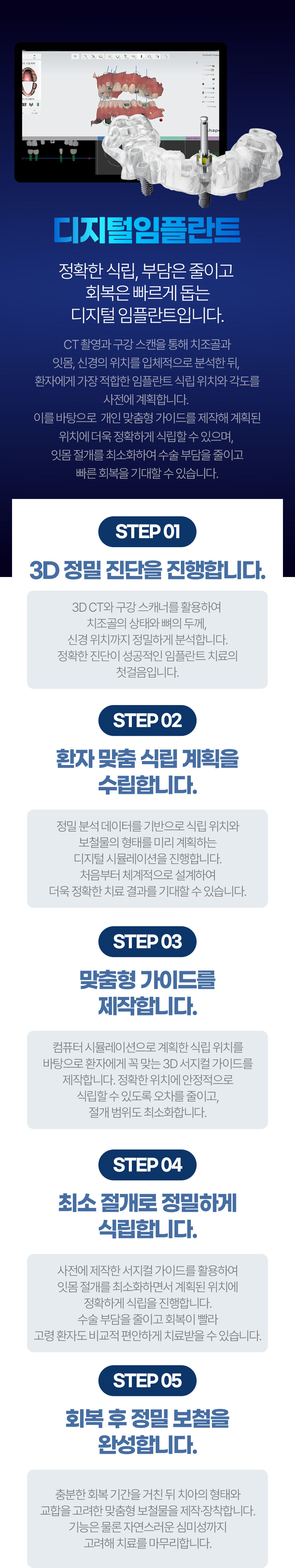 서울케이플란트치과 디지털임플란트 시술과정 3D 정밀진단 맞춤형 가이드