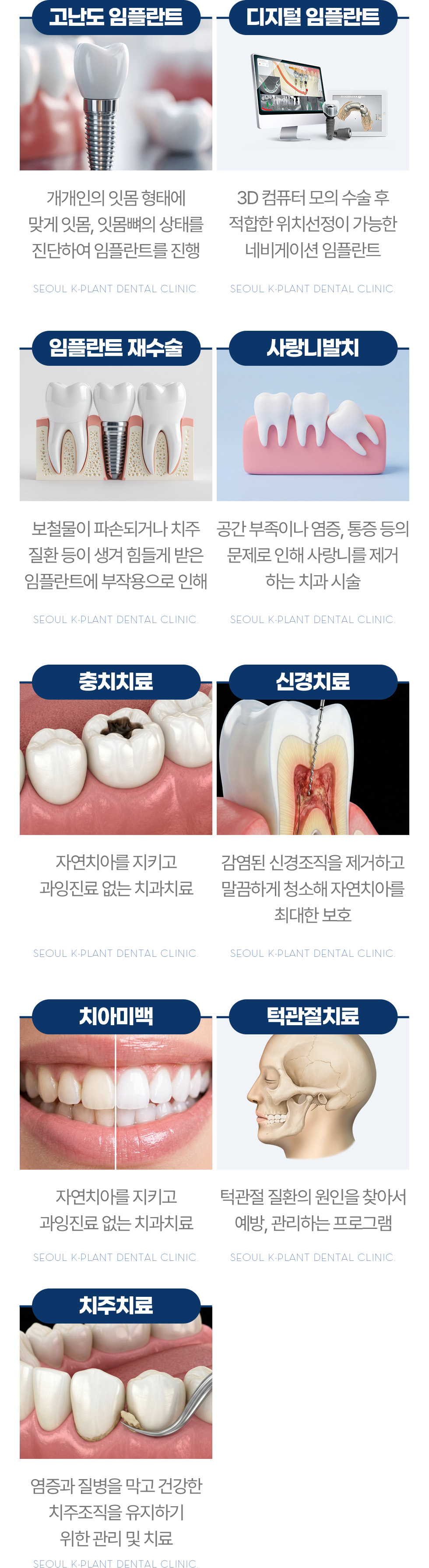 서울케이플란트치과 진료과목 고난도 임플란트 디지털 임플란트 사랑니발치 충치치료 신경치료 치주치료
